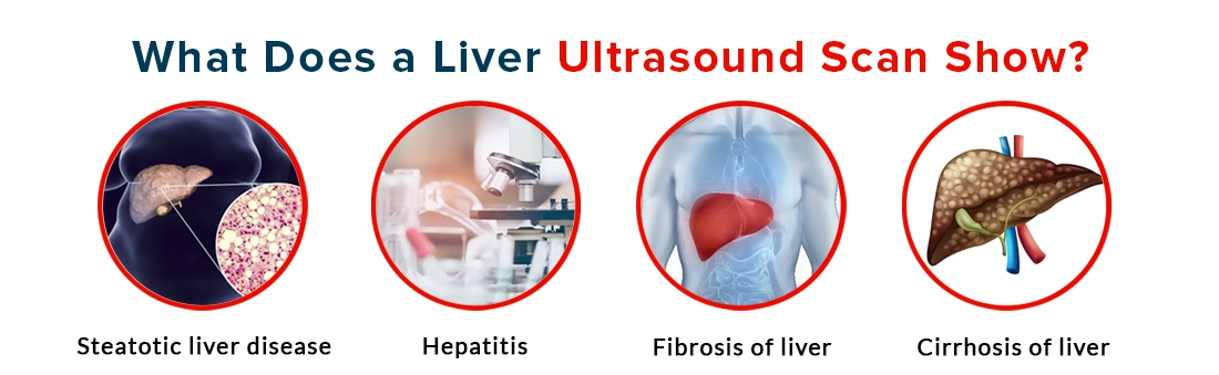 Liver Ultrasound Scan
